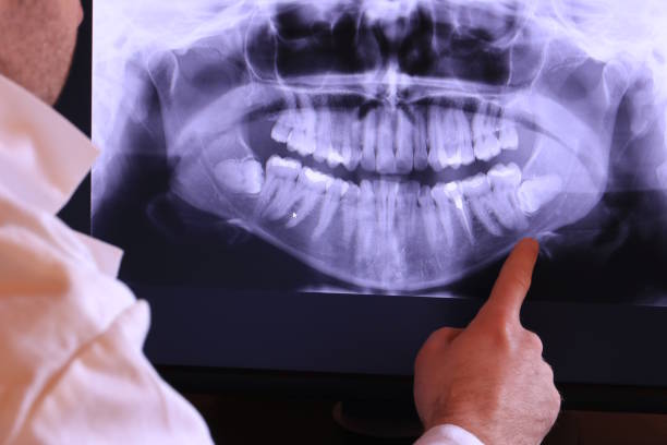 Best Emergency Denture Repair in Port Byron, IL