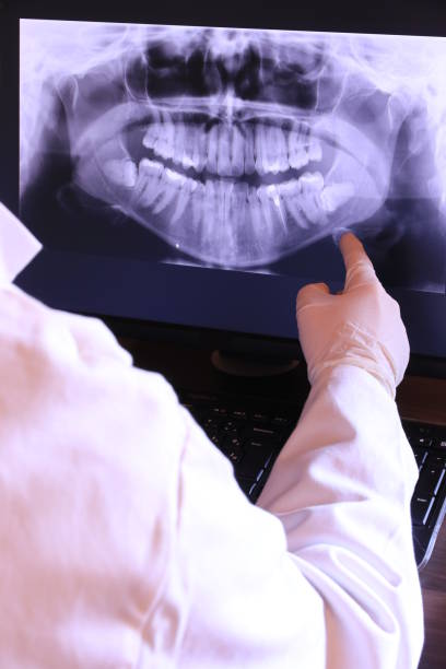 Best Emergency Tooth Extraction in Port Byron, IL
