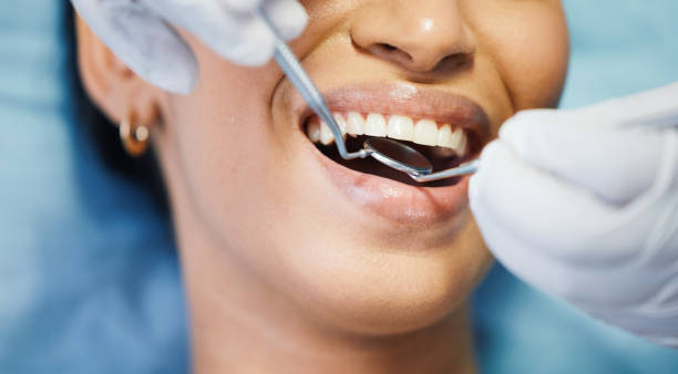 Best Cosmetic Emergency Dentistry in Port Byron, IL